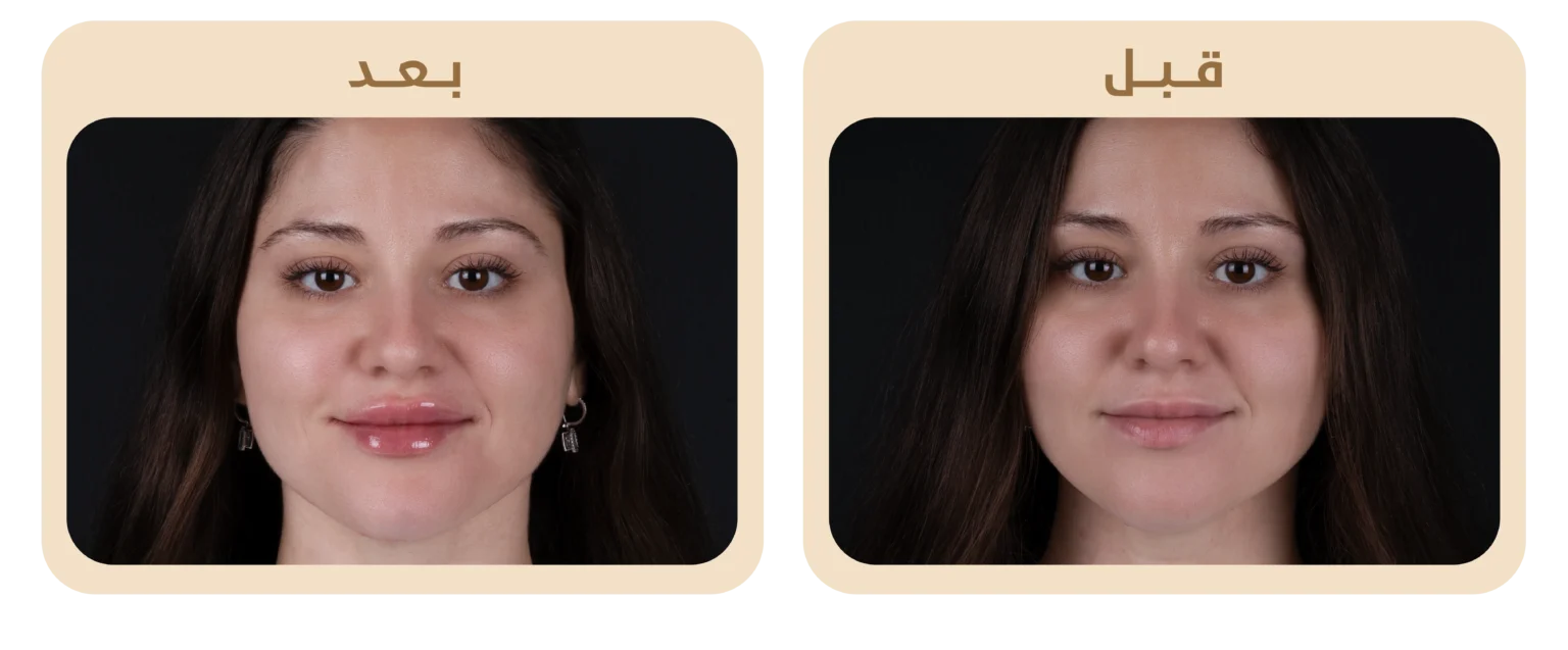 A1Face