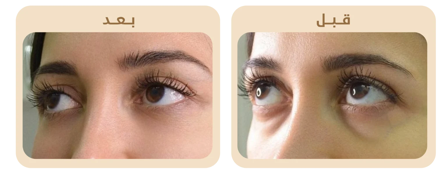Aeye