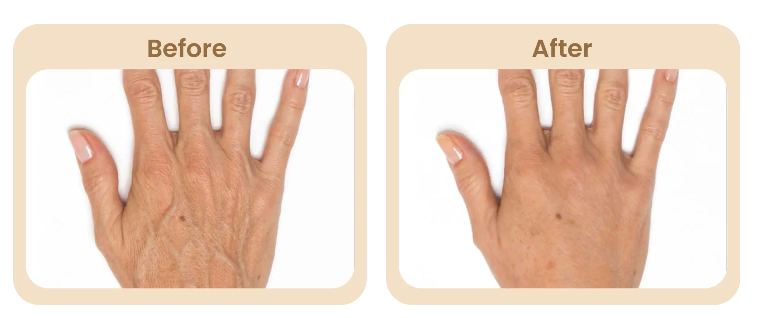 E1-Hand