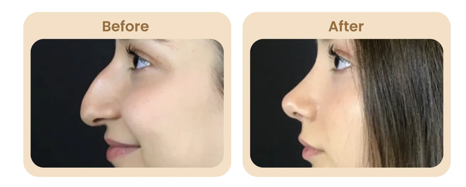 englishNose